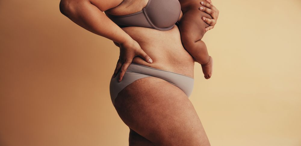Post-Pregnancy Fat Removal